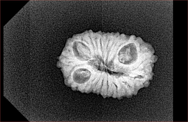 1 Mukhi - U/D 20 gm 15 mm - Inverse xray